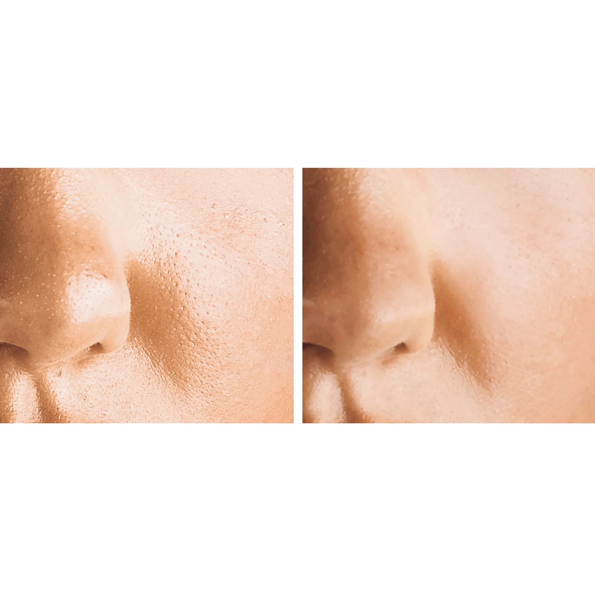Pore Tight™ Facial Serum