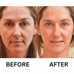 Retinol Wrinkle Miracle